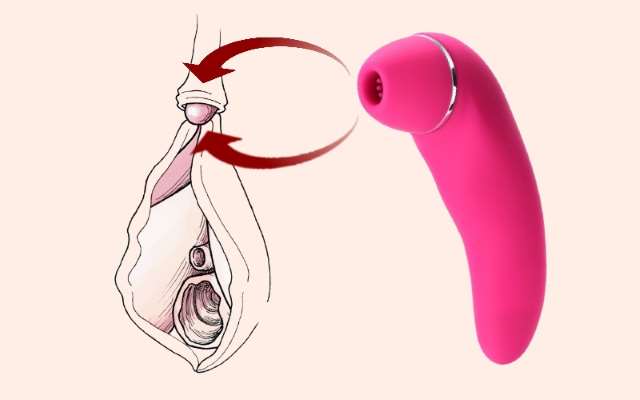 Clitoral Vibrator and Clitoris Diagram Pink clitoral vibrator with arrows pointing from the suction head to clitoris